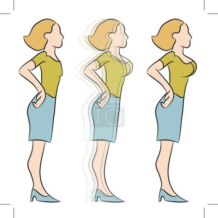 Ilustración de "Ampliación de mama Transformación "vector colorido ilustración - Imagen libre de derechos