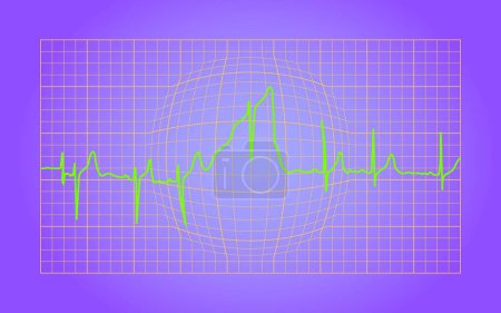 Téléchargez les illustrations : Ondes EKG, illustration vectorielle graphique - en licence libre de droit