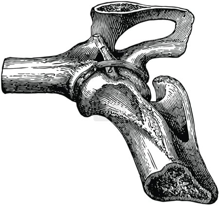 Ilustración de Ligamentos de la articulación de la cadera, ilustración vector vintage - Imagen libre de derechos