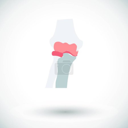 Illustration for "Knee-joint single icon." - Royalty Free Image