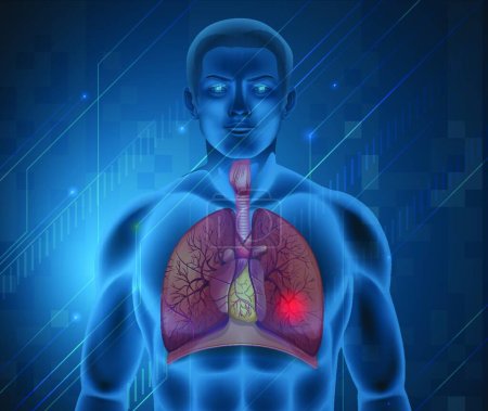 Téléchargez les illustrations : Illustration du système respiratoire humain - en licence libre de droit