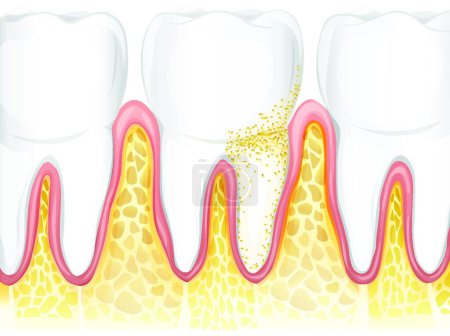 Illustration for Illustration of the Teeth - Royalty Free Image