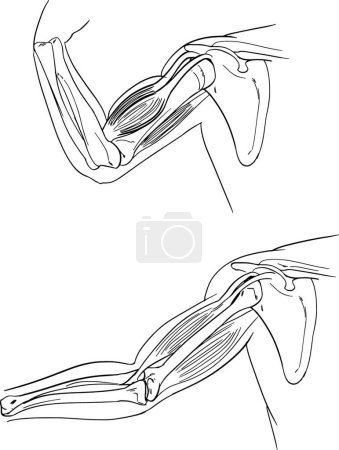 Ilustración de Ilustración del brazo humano - Imagen libre de derechos