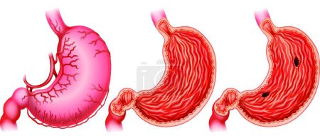 Ilustración de Anatomía estomacal vector ilustración - Imagen libre de derechos