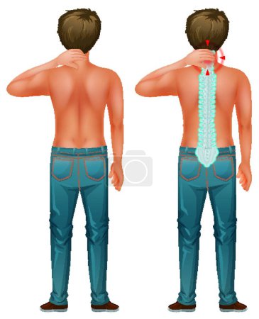Illustration for Back of man with spinal nerve problem - Royalty Free Image