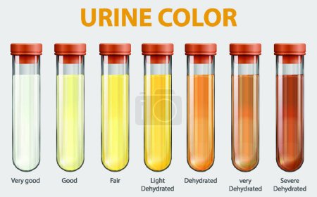 Illustration for "Illustration of urine color chart" - Royalty Free Image