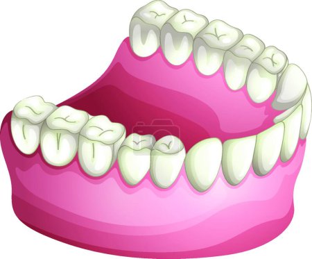 Ilustración de Ilustración de la prótesis dental - Imagen libre de derechos