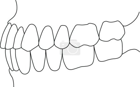 Téléchargez les illustrations : Morsure dentaire, illustration vectorielle des dents - en licence libre de droit