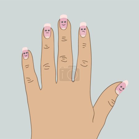 Illustration for Dystrophic ridges on the nails, colorful vector illustration - Royalty Free Image
