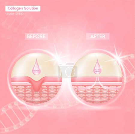 Prozess der Verjüngung der Haut mit Hilfe von Collagen Solution vor und nach Hautlösungen ad, Collagen Serum Drop mit kosmetischem Werbehintergrund. Vektor EPS10.