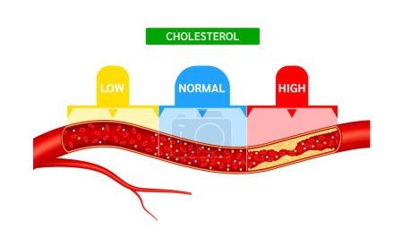 Medidor de colesterol o comparación de escalas con HDL Lipoproteína de alta densidad y LDL Lipoproteína de baja densidad. Flujo sanguíneo normal y enfermedad de la trombosis arterial del colesterol. Medicina y salud Vector.