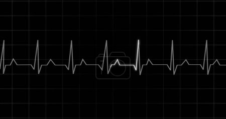 EKG Heartbeat lecture animation sur fond noir. Moniteur médical affichant la machine électronique d'affichage d'écran de diagnostic de contrôle d'impulsion de cardiographie. Cardiogramme nubes taux ecg forme d'onde chirurgie.