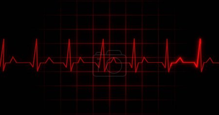 EKG Heartbeat lecture animation sur fond noir. Moniteur médical affichant la machine électronique d'affichage d'écran de diagnostic de contrôle d'impulsion de cardiographie. Cardiogramme nubes taux ecg forme d'onde chirurgie.