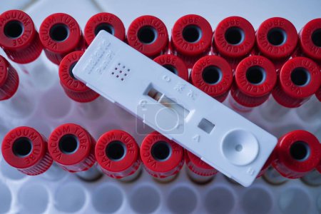 Téléchargez les photos : Test rapide du paludisme sur cassette située au-dessus du tube à vide rouge. affiche un résultat négatif.Espace de copie - en image libre de droit