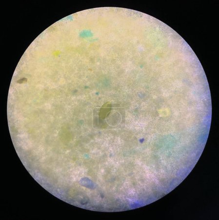 Foto de Trichuris trichiura huevo parásito humano en las heces prueba de examen encontrar microscopio - Imagen libre de derechos