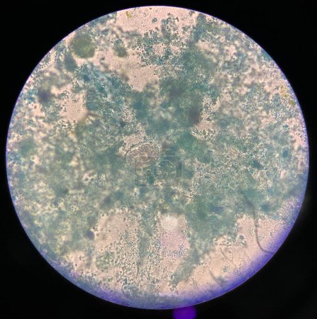 Foto de Ascaris lumbricoides huevos del parásito en humanos en el examen de las heces usando un microscopio. - Imagen libre de derechos