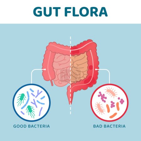 Illustration for Good and bad gut bacteria: comparison between healthy intestine and unhealthy intestine - Royalty Free Image