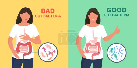 Téléchargez les illustrations : Bactéries intestinales bonnes et mauvaises : différence entre flore intestinale équilibrée et dysbiose intestinale - en licence libre de droit