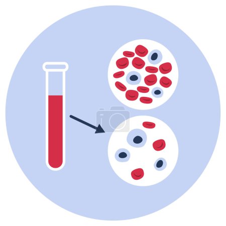 Illustration for Anemia: blood test comparison between healthy blood and anemic blood, isolated icon - Royalty Free Image