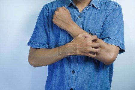 Man itching and scratching his arm from allergy symptoms on white background, health and medical care concept.