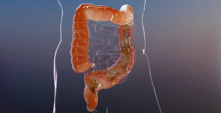 Téléchargez les photos : Illustration 3D de l'anatomie du système digestif humain, concept de l'intestin, laxatif, traitement de la constipation, rendu 3D - en image libre de droit