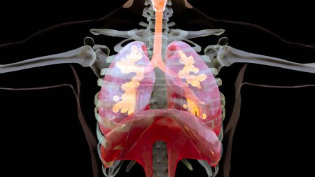 Pulmonary ventilation – maksuttomia kuvapankin valokuvia ja kuvia haulla  Pulmonary ventilation