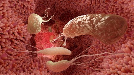 Téléchargez les photos : Helicobacter pylori illustration bactérie microaérophile qui infecte diverses zones de l'estomac et du duodénum. surface microvillosités. bactéries et viruse. 3d rendu - en image libre de droit