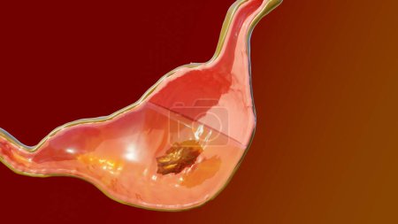 Foto de Ilustración 3d de la digestión de la anatomía del estómago humano, 3D reander3d Ilustración de la digestión de la anatomía del estómago humano, 3D reander - Imagen libre de derechos