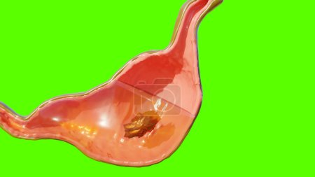 Foto de Ilustración 3d de la digestión de la anatomía del estómago humano, reander 3D - Imagen libre de derechos