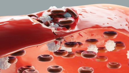 Photo for Hemostasis. Red blood cells and platelets in the blood vessel. Basic steps of wound healing process. 3d illustration - Royalty Free Image