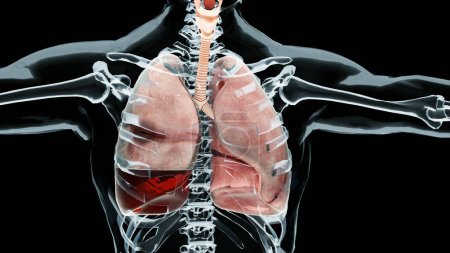 3D Illustration des Hämopneumothorax, normale Lunge versus Kollaps, Symptome des Hämopneumothorax, Pleuraerguss, Empyema, Komplikationen nach einer Brustverletzung, Luft im Pleuraraum, 3D Render