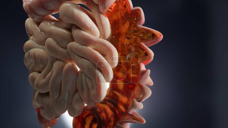 Téléchargez les photos : Anatomie du système digestif humain, concept de l'intestin, diverticulite, rendu 3d - en image libre de droit