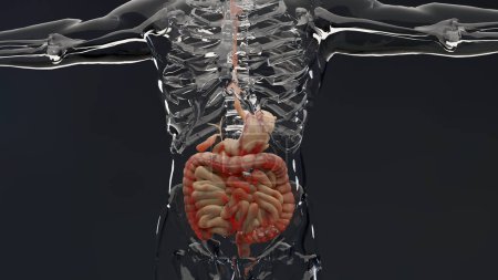 Photo for Man suffering from crohns disease, male anatomy, inflamed large intestine, Sigmoid Colon, human digestive system parts, 3d render - Royalty Free Image
