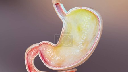 Photo for Human stomach with gases. Bloating and flatulence, flatulence and gastrointestinal tract, Bloating digestion system, stomach ache or cramps, gastritis, stomachache, indigestion, vomiting, 3d render - Royalty Free Image