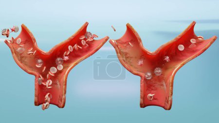 Photo for Anemia amount of blood cell or hemoglobin and normal. Aplastic anemia, normal and abnormal blood cell and platelets count, circulation in an artery or vein, Anaemia Disease, Iron deficiency, 3d render - Royalty Free Image
