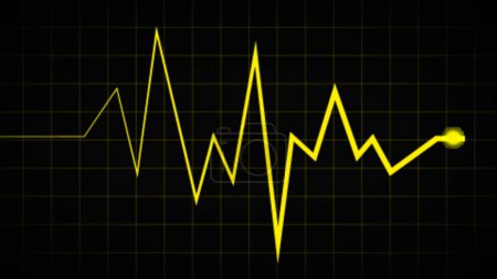 Schnell langsame unregelmäßige Herzschlagwellen ecg Sinusrhythmusvektordiagramm Illustration für die Kardiologie Medizin Lehre zeigt normale und abnormale menschliche Herzschlagraten.