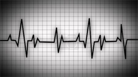 gráfico de frecuencia cardíaca. El latido del corazón. Icono de onda Ekg. Un gráfico de latidos del corazón. Latidos cardíacos normales en el electrocardiograma (ritmo sinusal). ECG. ECG. indicación de vida. símbolo médico para la salud