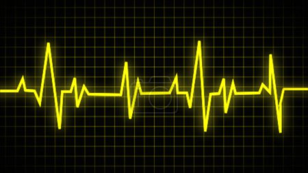 Téléchargez les photos : Rythme cardiaque normal sur électrocardiogramme (rythme sinusal). ECG et ECG. indication de vie. symbole médical pour la santé - en image libre de droit