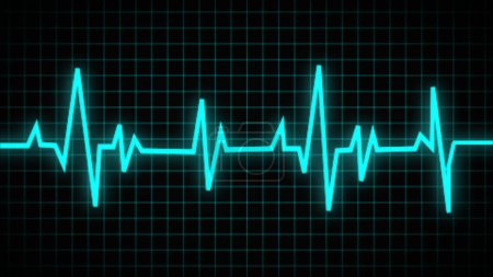 Photo for Collection of normal and abnormal ECGs. Vector of an electrocardiogram, ecg, or medical icon. A heartbeat graph - Royalty Free Image