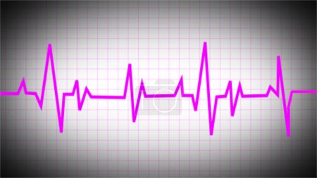 Photo for An electrocardiogram reveals Pattern of sinus tachycardia. Fibrillation of the heart. The heartbeat. CPR. ECG. EKG. indication of life. support for life. Defib. Emergency. healthcare symbol in medicine. - Royalty Free Image