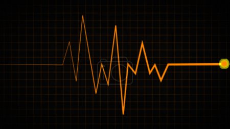 Téléchargez les photos : ECG Heartbeat Display, électrocardiogramme. Histoire médicale. Ligne de fréquence d'impulsion sur la toile de fond du graphique vert de l'écran. Illustration du moniteur de fréquence cardiaque et cardiogramme. - en image libre de droit