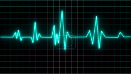Elektrokardiogramm zeigt Pulsfrequenzgraph, Herzschlag, EKG, EKG-Interpretation, Vitalzeichen, Lebenslinie, medizinisches Gesundheitssymbol.