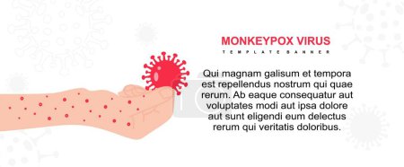 Illustration for Monkeypox disease concept. vector illustration. - Royalty Free Image