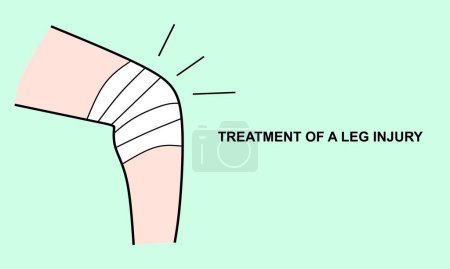 Ilustración de Tratamiento de una lesión en la pierna, dolor en el cuerpo humano, ilustración vectorial - Imagen libre de derechos