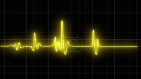 Téléchargez les photos : Cardiogramme cardiographe oscilloscope écran jaune fond illustration. Surveillance ekg d'urgence. pouls jaune fluo lumineux. Rythme cardiaque. Électrocardiogramme - en image libre de droit