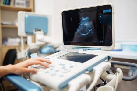 Foto de Ultrasound machine in the doctor's office in the clinic  Diagnostics. Sonography. Pregnancy. - Imagen libre de derechos
