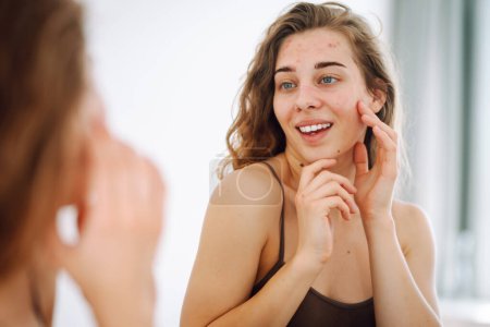 Téléchargez les photos : Gros plan d'une jeune femme regardant des boutons dans le miroir. Belle femme avec problème d'acné peau vérifie peau sèche visage. Taches rouges, éruption cutanée, acné. Traitement de la peau. - en image libre de droit