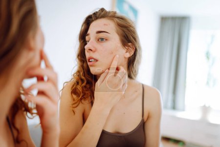Téléchargez les photos : Portrait d'une jeune femme touchant un bouton sur son visage en se regardant dans le miroir. Problèmes de peau du visage, soins médicaux et concept de traitement. - en image libre de droit