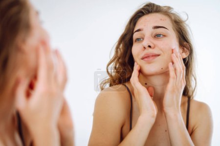 Téléchargez les photos : Portrait d'une jeune femme touchant un bouton sur son visage en se regardant dans le miroir. Problèmes de peau du visage, soins médicaux et concept de traitement. - en image libre de droit
