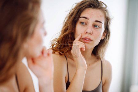 A young woman looks in the mirror examining inflammation on her face. Acne skin. Copy space. Medicine and cosmetology.